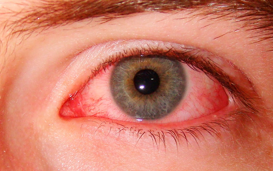 Как сделать на время красные глаза
