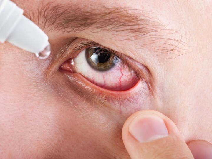 Какие капли для глаз будут способствовать улучшению зрения: список