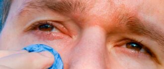 Чем промывать глаза при конъюнктивите?