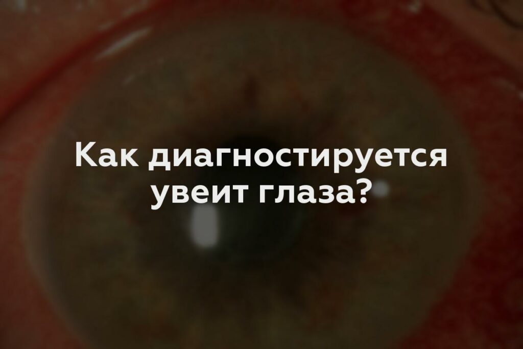 Как диагностируется увеит глаза?