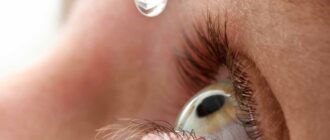Как остановить катаракту на начальной стадии?