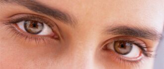 Как снять отек глаза при конъюнктивите?