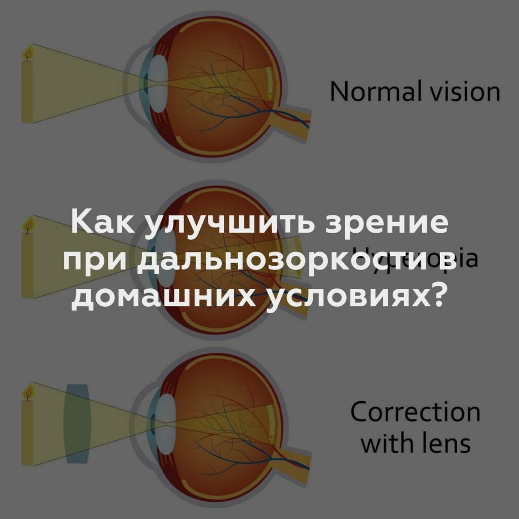 Как улучшить зрение при дальнозоркости в домашних условиях?