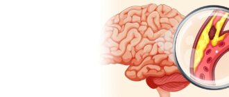 Как восстановить работу сосудов головного мозга?