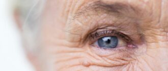Как выглядят глаза с катарактой?