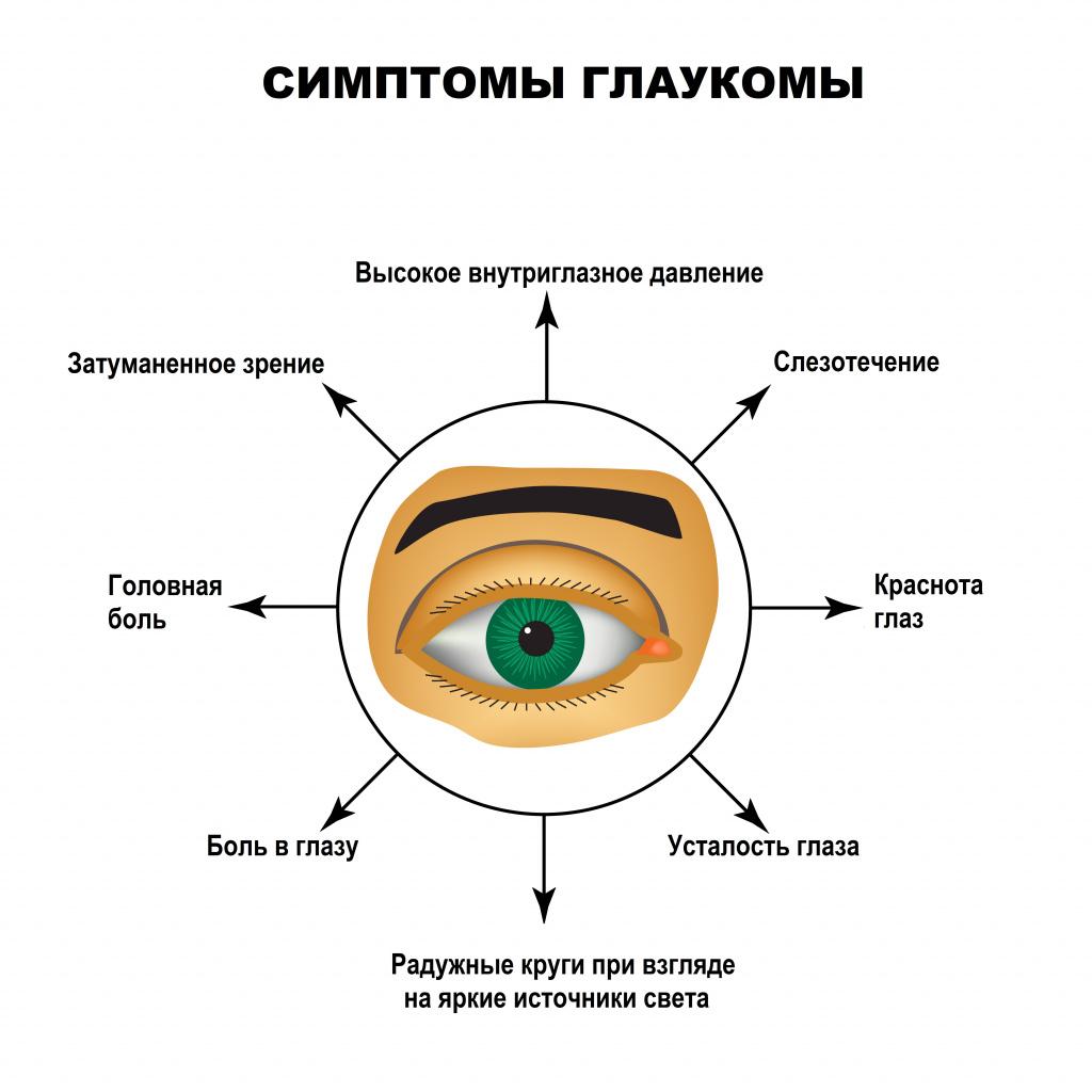 Какие первые симптомы глаукомы?