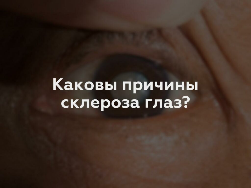 Каковы причины склероза глаз?