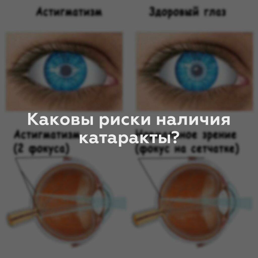 Каковы риски наличия катаракты?