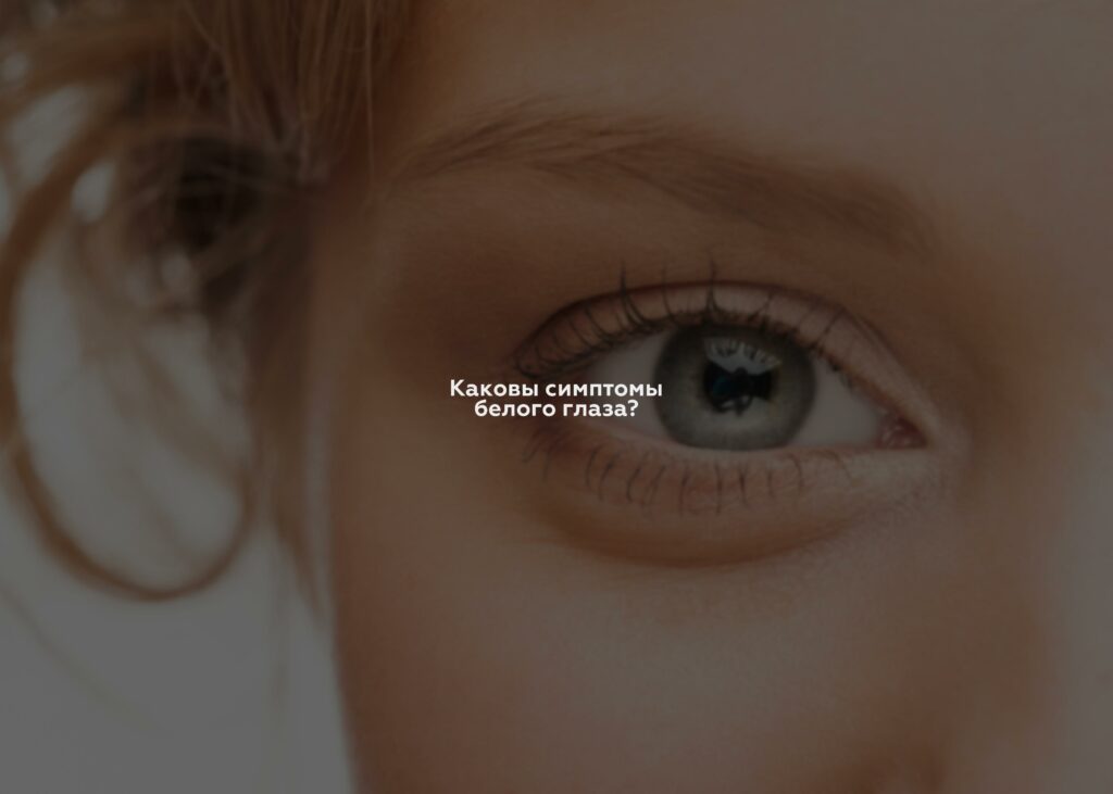 Каковы симптомы белого глаза?