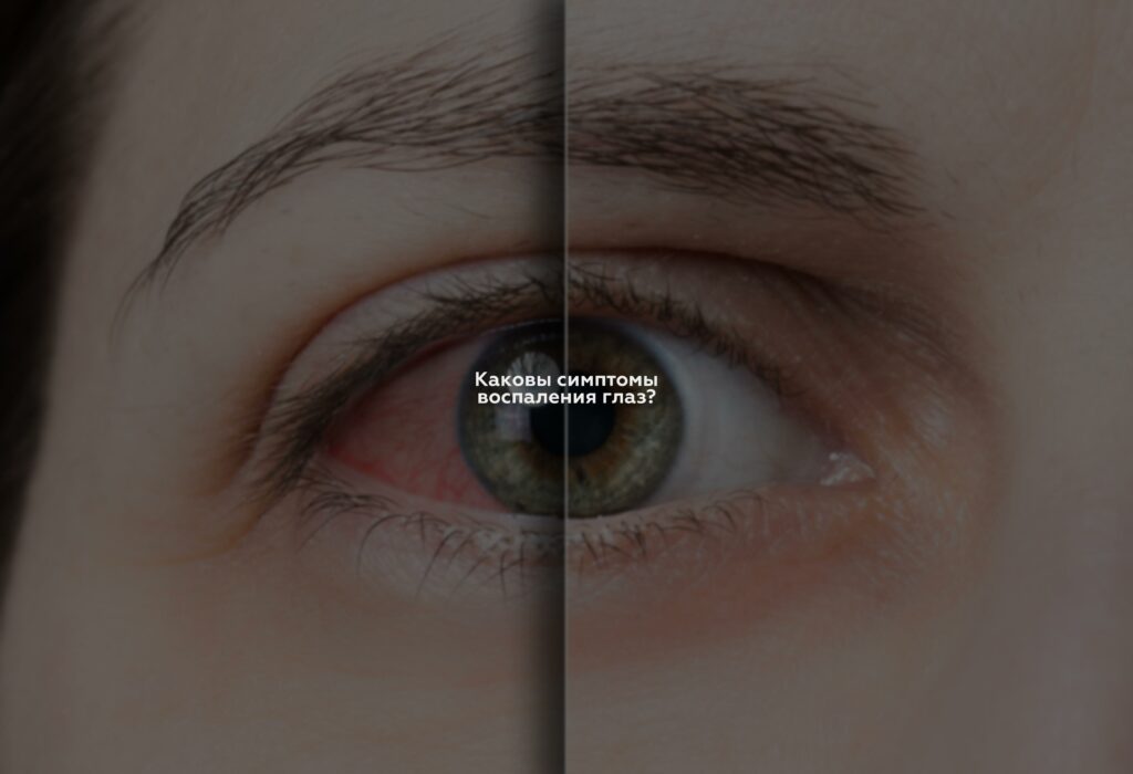 Каковы симптомы воспаления глаз?