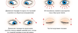 Что сужает сосуды глаз?